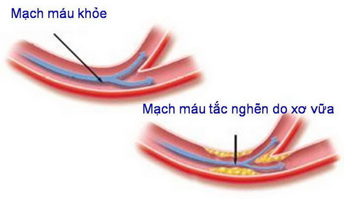 Nấm linh chi, vị thuốc tốt bổ khí